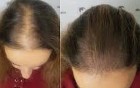 SUPER MASSAGE -EPILATION 