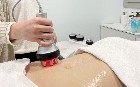  Lifting colombien Augmenter le volume fessiers