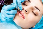 ✨ Traitements Botox & Acide Hyaluronique ✨