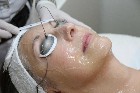 ✨ Traitements Botox & Acide Hyaluronique ✨