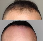 SUPER MASSAGE -EPILATION 